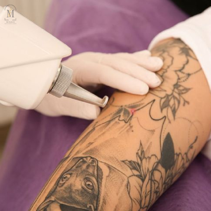 GFC Hair Treatment in Rohini