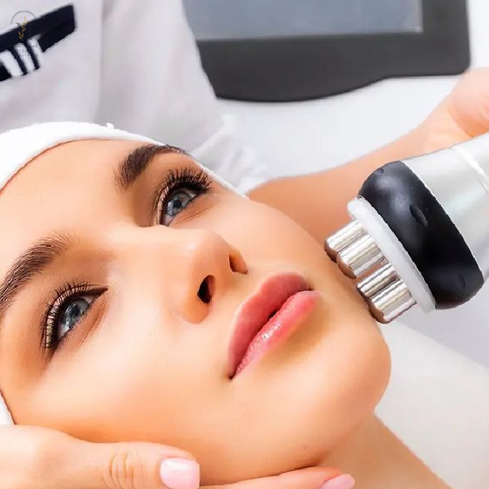 Radio Frequency Skin Tightening