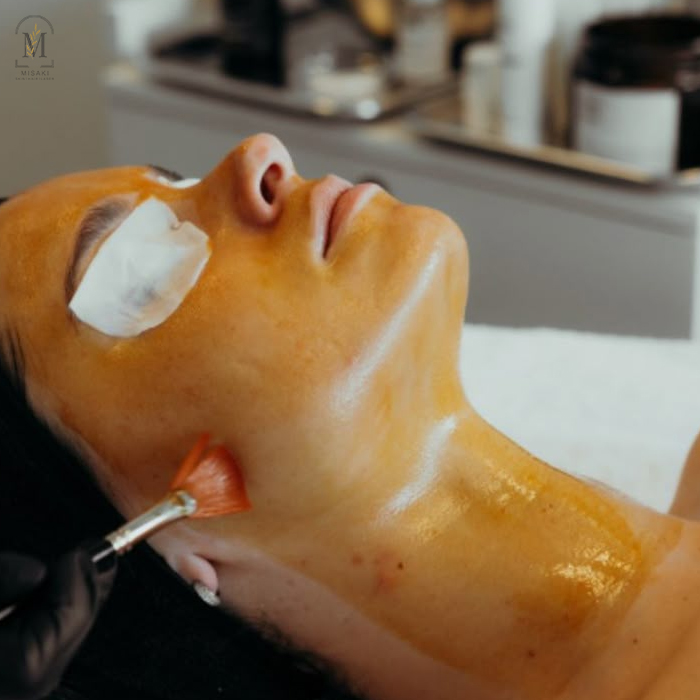 Micro Needling Treatment in Rohini