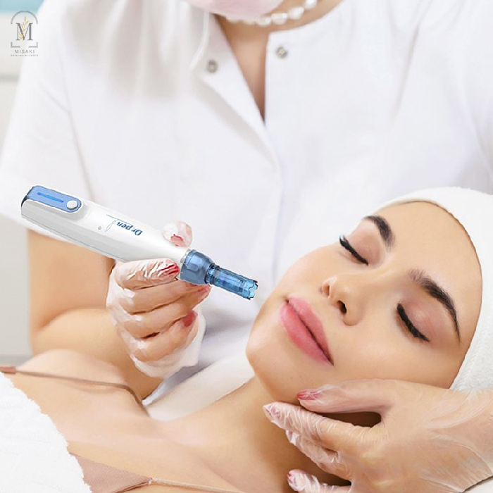 Micro Needling Treatment in Rohini