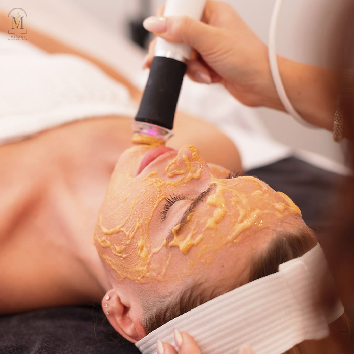 OxyGeneo Facial Treatment