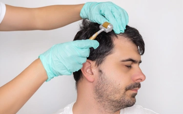 Hair Mesotherapy Treatment