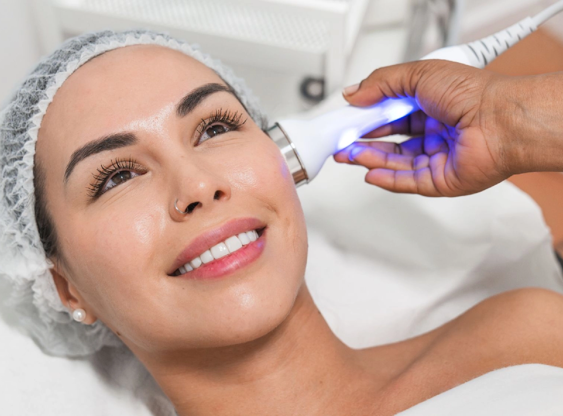 Body laser toning treatment for pigmentation