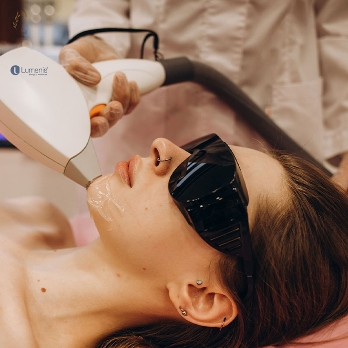 Laser Hair Removal Using LightSheer Diode Laser