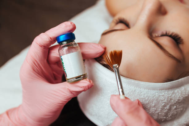 Chemical Peel Treatment for Skin Rejuvenation