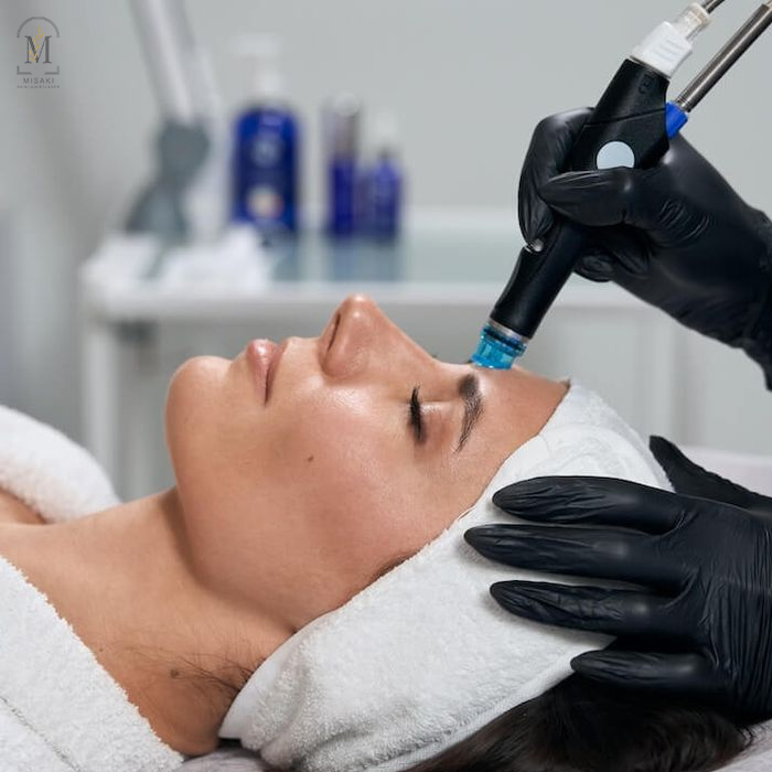 GFC Hair Treatment in Rohini