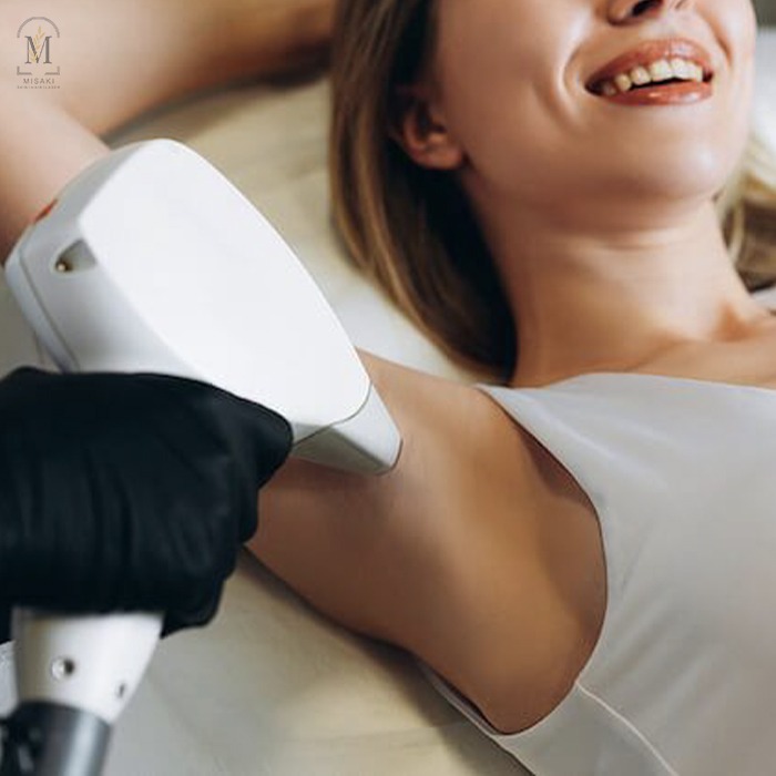 Laser Hair Removal in Rohini