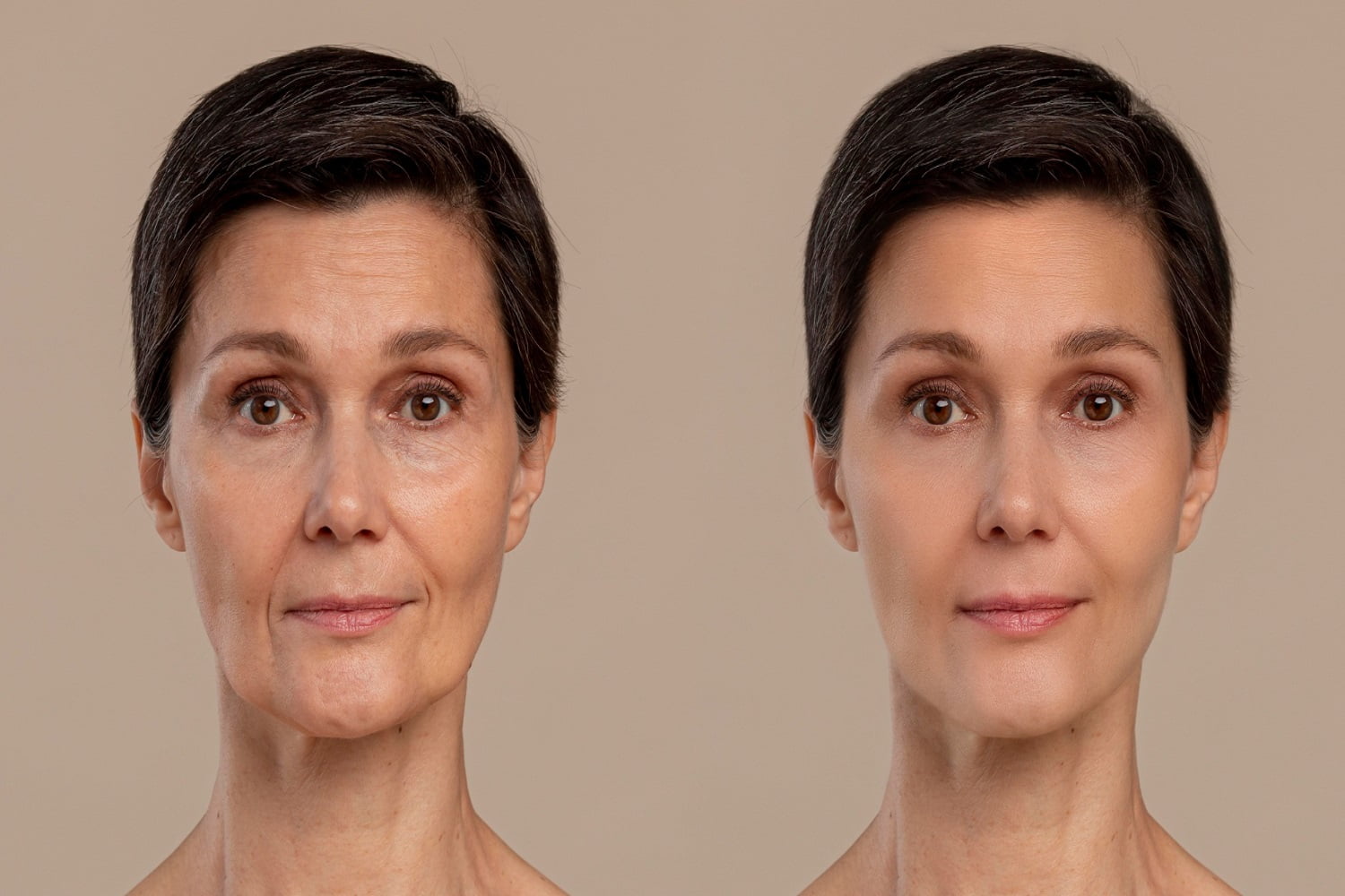 antiaging-beauty-treatment